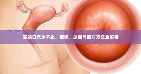 宫颈口流水不止，症状、原因与应对方法全解析