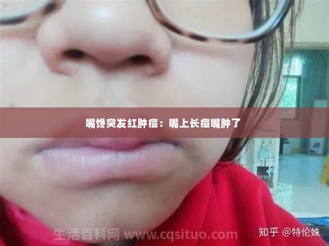 嘴馋突发红肿痘：嘴上长痘嘴肿了 