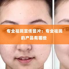 专业祛斑宣传图片：专业祛斑的产品有哪些 