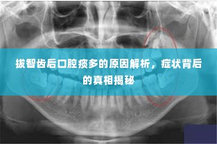 拔智齿后口腔痰多的原因解析，症状背后的真相揭秘