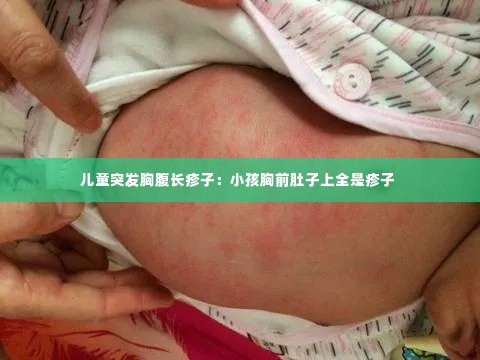 儿童突发胸腹长疹子：小孩胸前肚子上全是疹子 