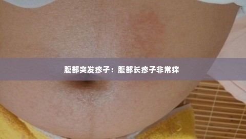 腹部突发疹孑：腹部长疹子非常痒 