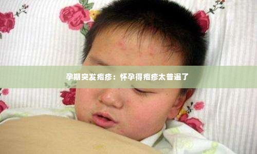 孕期突发疱疹：怀孕得疱疹太普遍了 
