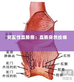 突发性直肠疼：直肠突然绞痛 