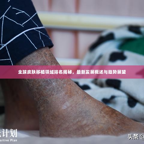全球皮肤移植领域排名揭秘，最新发展概述与趋势展望