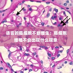 语言的癌细胞不断增生：癌细胞增殖不会出现什么现象 