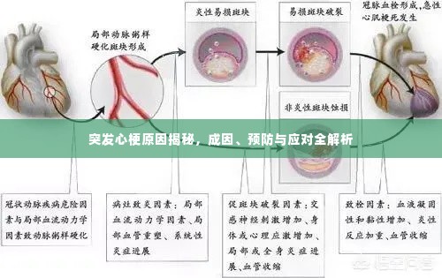 突发心梗原因揭秘，成因、预防与应对全解析