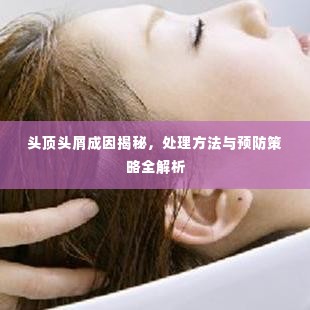 头顶头屑成因揭秘，处理方法与预防策略全解析