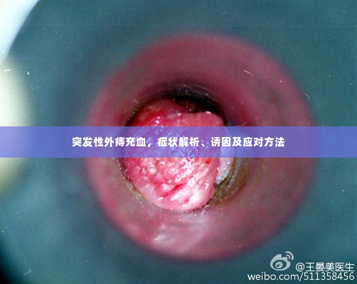 突发性外痔充血，症状解析、诱因及应对方法