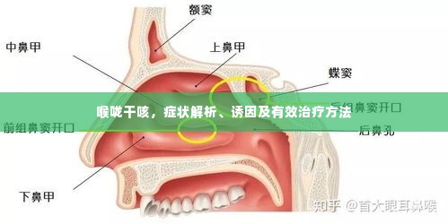 喉咙干咳，症状解析、诱因及有效治疗方法